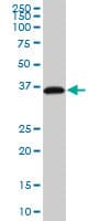 Monoclonal Mouse anti-Human RP2 Antibody (clone 1B4, WB)