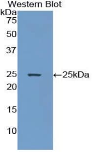 IFNAR1 / IFNAR Antibody (aa28-227)