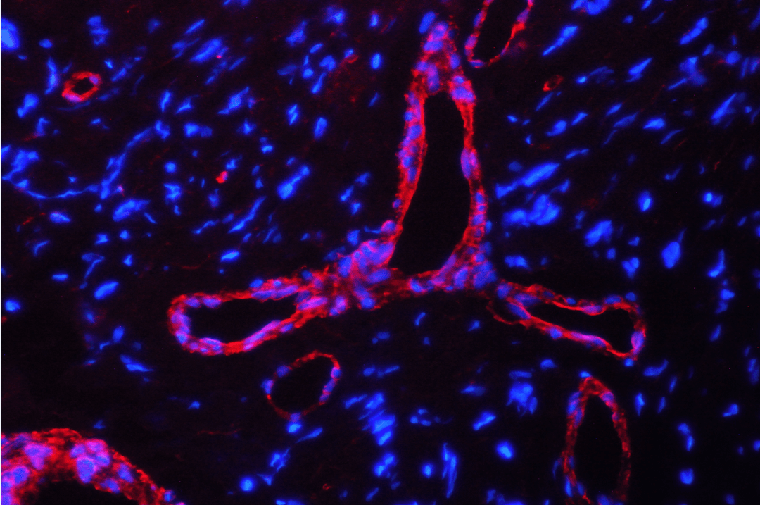 Polyclonal Rabbit anti-Human CAV1 / Caveolin 1 Antibody (aa4-178, IHC, WB)