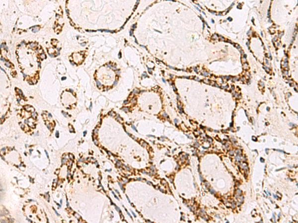 Polyclonal Rabbit anti-Human ATP5O Antibody (IHC, WB)