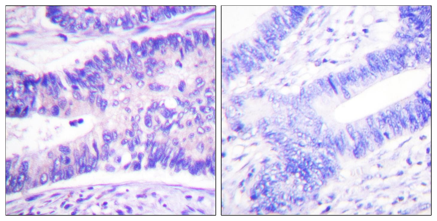 WASF1 / WAVE Antibody (phospho-Tyr125)