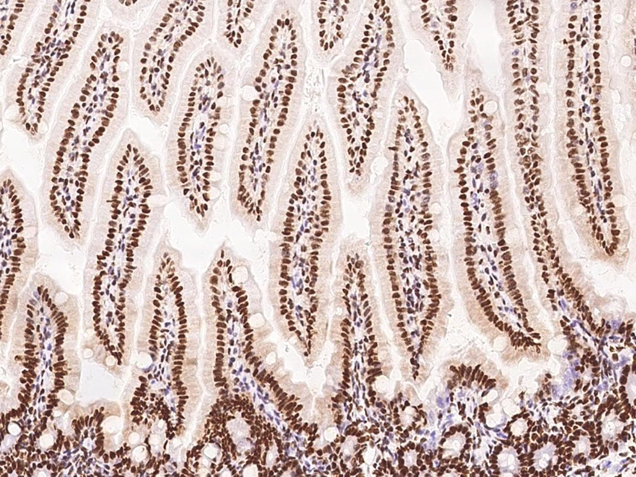 PTBP1 Antibody (Preservative Free)