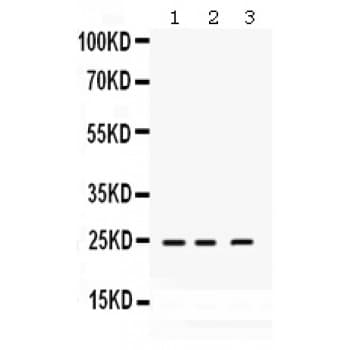 RAB14 Antibody (aa124-153)
