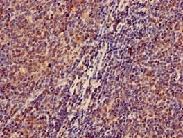 ZKSCAN3 / ZNF306 Antibody