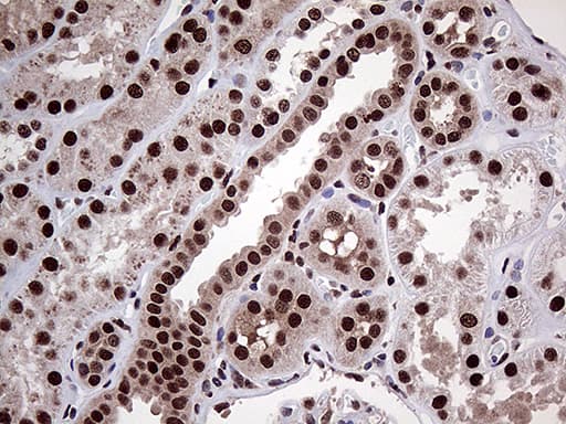 PPP4C Antibody (clone OTI2E4)