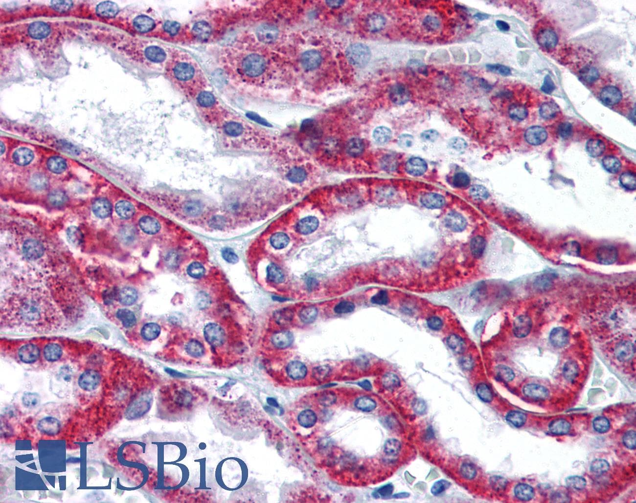 IHC-plus™ SDC2 / Syndecan 2 Antibody (Internal)