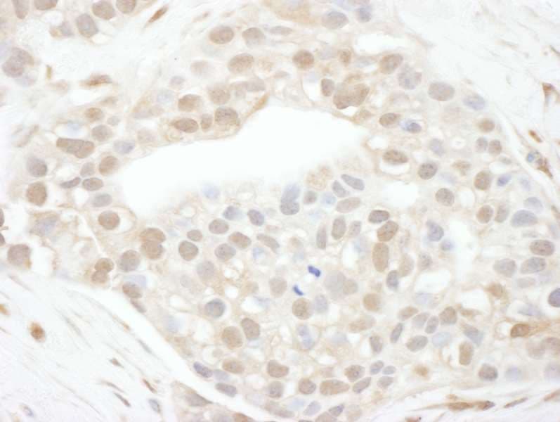 CCNT1 / Cyclin T1 Antibody (aa250-300)
