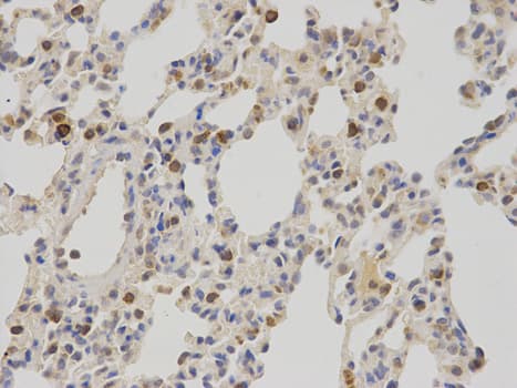 Polyclonal Rabbit anti-Human NR0B2 Antibody (IHC, IF, WB)