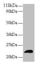 IHC-plus™ Polyclonal Rabbit anti-Human LCN2 / Lipocalin 2 / NGAL Antibody (IHC, WB)