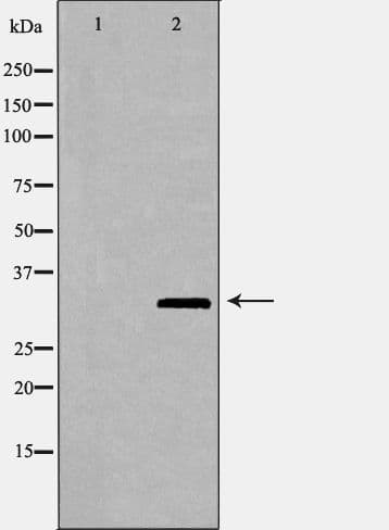 FBL / FIB / Fibrillarin Antibody