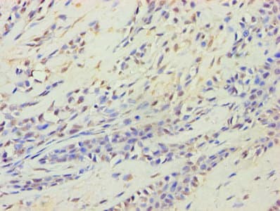 HARS2 Antibody