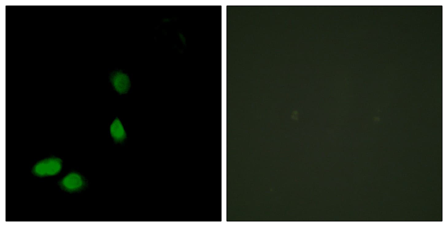 IHC-plus™ HMGN2 Antibody (aa1-50)
