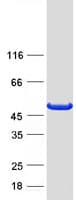 Human PHYKPL / AGXT2L2 Protein (Recombinant Myc-DDK (Flag))