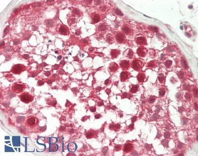 IHC-plus™ HEC1 / NDC80 Antibody (aa351-400)