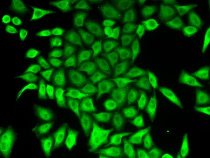 Polyclonal Rabbit anti-Human APRT Antibody (aa1-180, IHC, IF, WB)