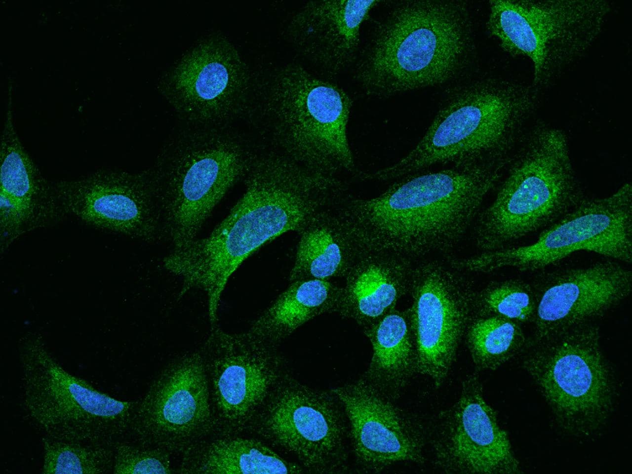 DERL2 / Derlin-2 Antibody