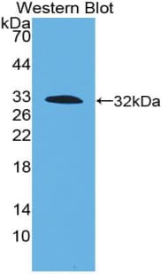 F3 / CD142 / Tissue factor Antibody (aa30-251)