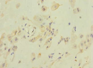 ZFPM2 / FOG2 Antibody
