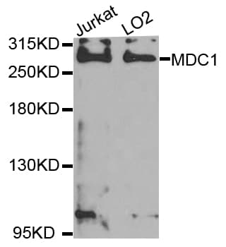 Polyclonal Rabbit anti-Human MDC1 Antibody (IHC, WB)
