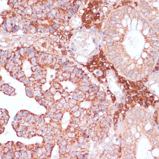 Polyclonal Rabbit anti-Human MZB1 Antibody (IHC)