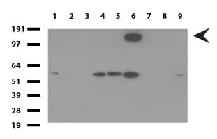 PECAM-1 / CD31 Antibody (clone UMAB164, Carrier-free)