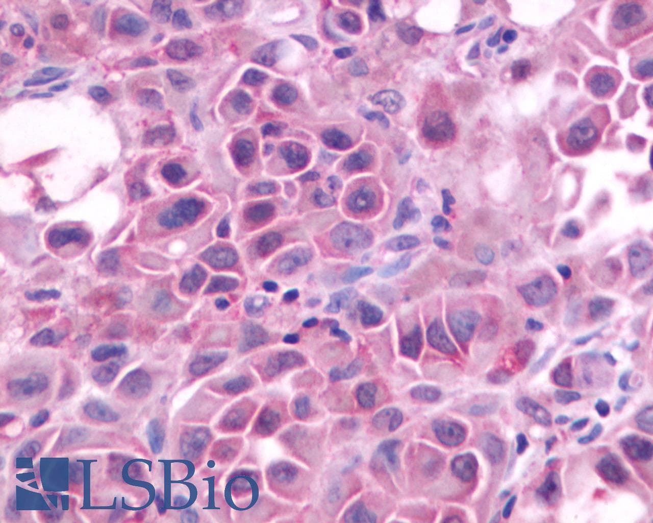 PathPlus™ Polyclonal Rabbit anti-Human GRPR Antibody (Extracellular Domain, IHC, WB)