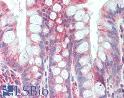 IHC-plus™ Polyclonal Rabbit anti-Human DSG2 / Desmoglein 2 Antibody (aa825-875, IHC, WB)