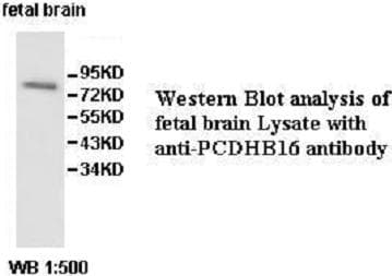 PCDHB16 Antibody (aa199-458)