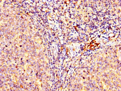 Polyclonal Rabbit anti-Human LAG3 Antibody (aa29-450, WB)