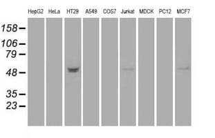 Monoclonal Mouse anti-Human STK39 / SPAK Antibody (clone OTI2E10, IHC, WB)