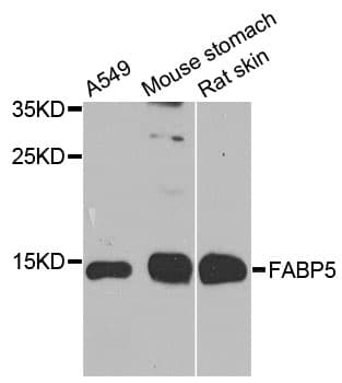 E-FABP / FABP5 Antibody