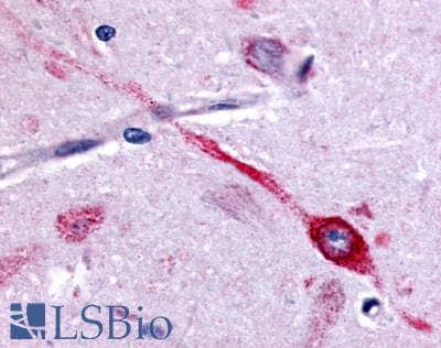PathPlus™ CHRM2 / M2 Antibody (Cytoplasmic Domain)
