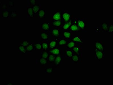 FEV / PET1 Antibody