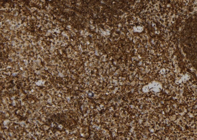 USP31 Antibody