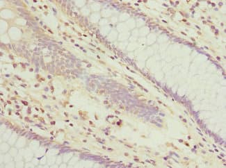 TUSC2 / FUS1 Antibody