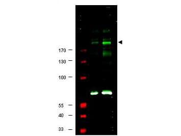 Polyclonal Rabbit anti-Human IRS1 Antibody (phospho-Ser307, IHC, WB)