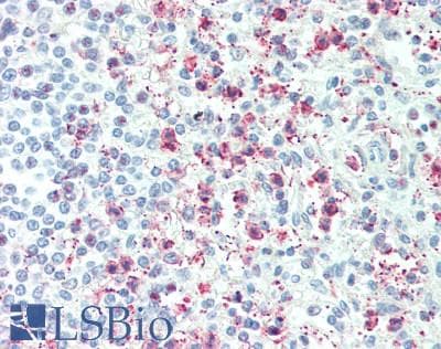 Polyclonal Rabbit anti-Mouse TNFAIP6 / TSG-6 Antibody (aa18-275, IHC, WB)