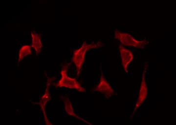 Polyclonal Rabbit anti-Human IL17RC Antibody (IF, WB)