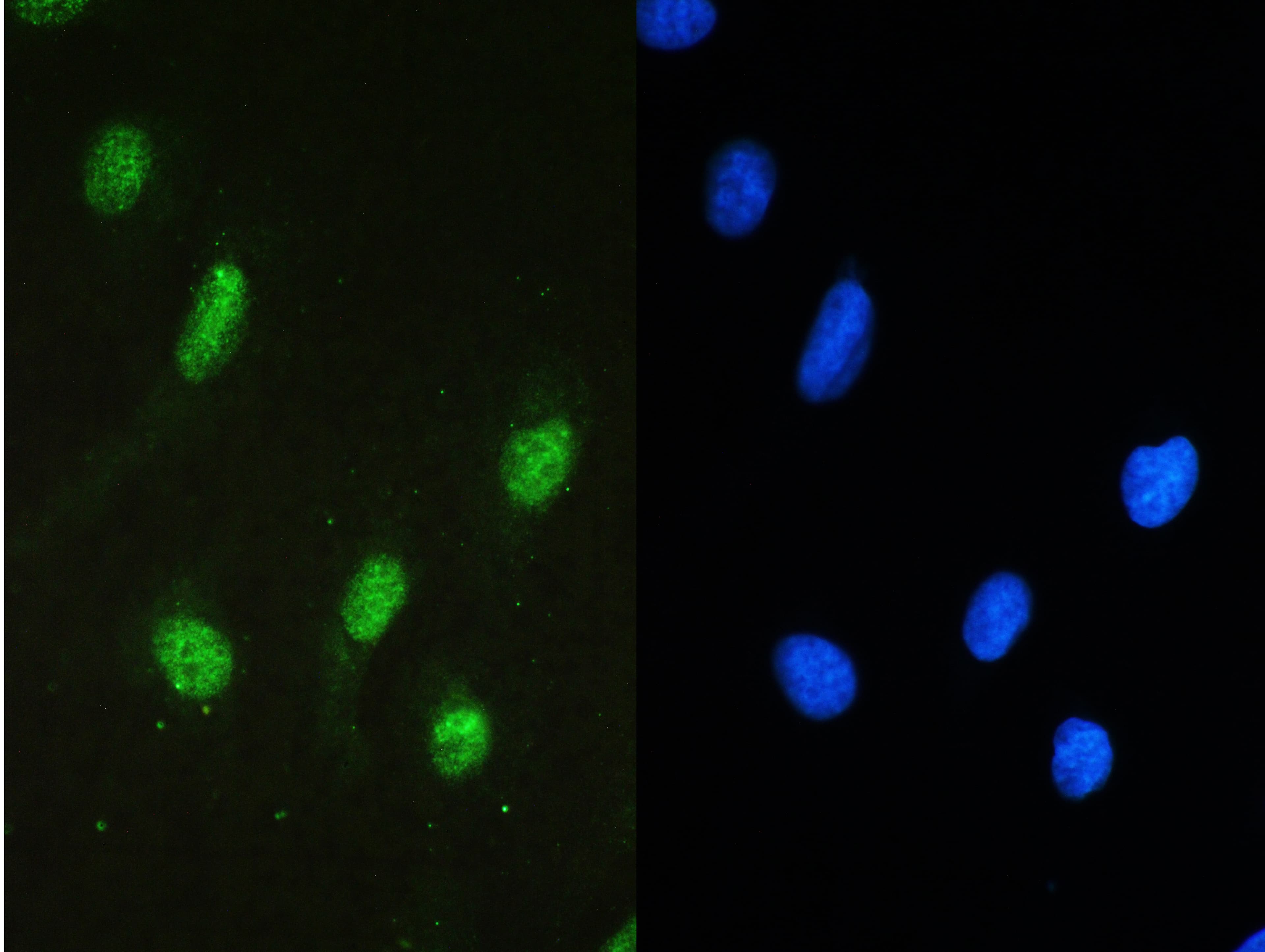STAT1 Antibody