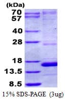 Human NDUFA5 Protein (Recombinant His)
