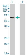 IHC-plus™ Monoclonal Mouse anti-Human IRAK1 / IRAK Antibody (clone 3A9, IHC, IF, WB)