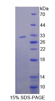 Mouse NUP85 / Pericentrin 1 Protein (Recombinant His-T7)