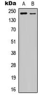 KDR / VEGFR2 / FLK1 Antibody (phospho-Tyr1175)