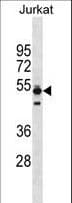 TMPO / TP / Thymopoietin Antibody (aa243-269)
