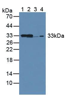 CBR / CBR1 Antibody (aa66-271, APC)