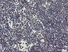 NONO / P54NRB Antibody (aa184-385, clone OTI5F1)