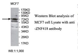 ZNF418 Antibody (aa124-416)