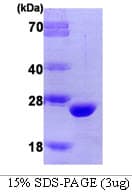 Human COMT Protein (Recombinant)