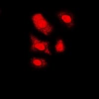 FKBP6 Antibody