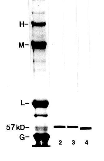 Peripherin Antibody (clone 8G2)